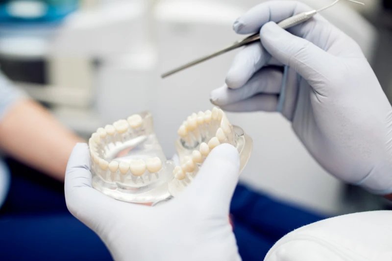 Tecnologia - Implantes - dentarios
